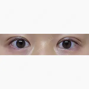 アリエル美容クリニック 大宮院口コミ