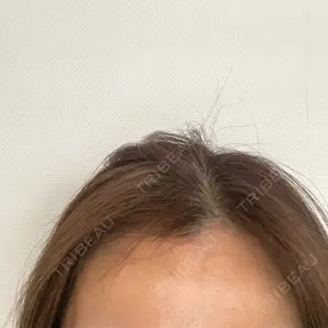 TCB東京中央美容外科 金沢院口コミ