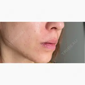 ルラ美容クリニック 静岡院口コミ