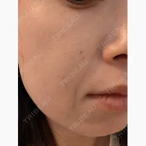 ゆきスキンクリニック 東池袋口コミ