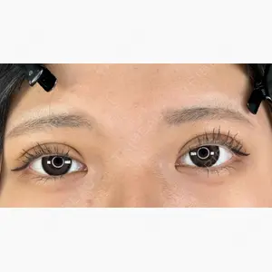 アリエル美容クリニック 郡山院口コミ