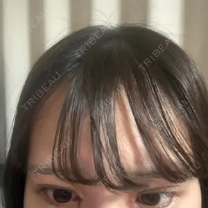 愛知春日井美容外科ネビュラクリニック口コミ