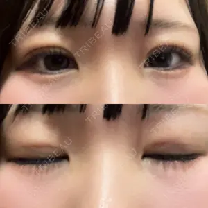 愛知春日井美容外科ネビュラクリニック口コミ