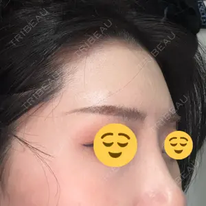 HAAB×DREAM BEAUTY CLINIC 東京本院口コミ