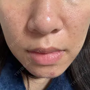 TUNE CLINIC【チューンクリニック】口コミ