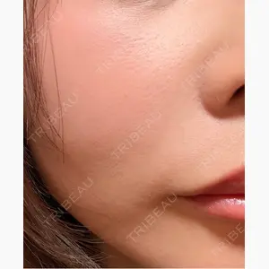 Chloe Cheongdam Clinic （クロエチョンダムクリニック）口コミ