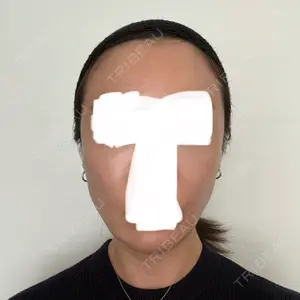 フィラークリニック 新宿院口コミ