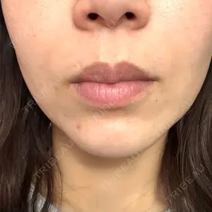 つだ美容外科クリニック口コミ