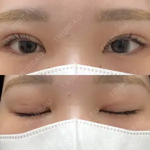 東京シンデレラ美容外科 池袋院口コミ