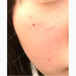 ジュエルクリニック 恵比寿院口コミ