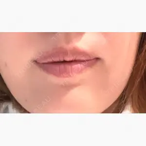 REDLINE CLINIC口コミ