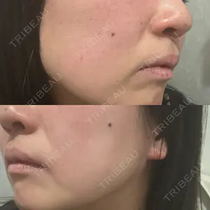 ルラ美容クリニック 静岡院口コミ