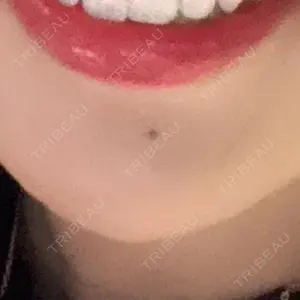 PRO CLINIC プロクリニック 銀座院口コミ