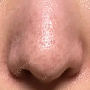 ゆきスキンクリニック 東池袋口コミ