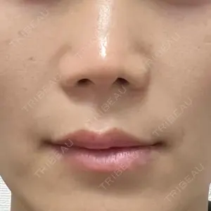 EMMO FACE CLINIC 東京三田院口コミ