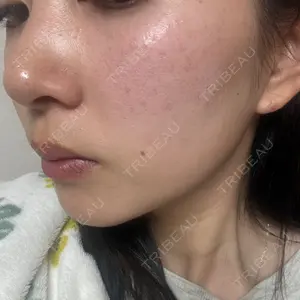 ルラ美容クリニック 岡山院口コミ