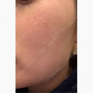 おおかみ美容のクリニック 新宿院口コミ