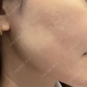 L‘amour clinic Tokyo【ラムールクリニック東京】口コミ