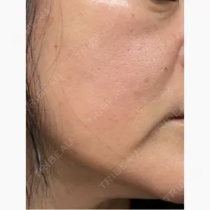 東京美容皮膚科アロエクリニック池袋口コミ