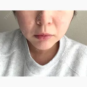 ウィルビークリニック 立川院口コミ