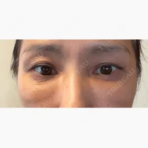 アリエル美容クリニック 大宮院口コミ