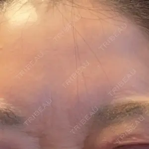 東京美容皮膚科アロエクリニック池袋口コミ