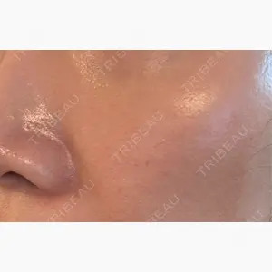 ゆきスキンクリニック 東池袋口コミ