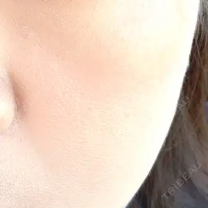 ルラ美容クリニック 名古屋本院口コミ