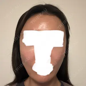 フィラークリニック 新宿院口コミ