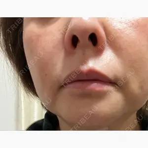 筋肉・美容クリニック口コミ