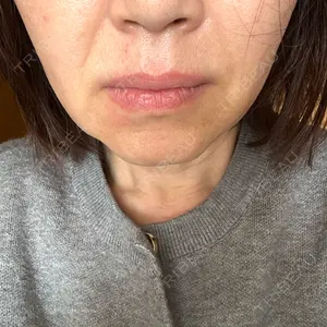 おおかみ美容のクリニック 新宿院口コミ