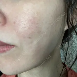 ゆきスキンクリニック 東池袋口コミ