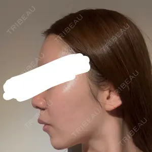 DaysBeautyClinic 銀座院口コミ