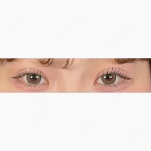 アリエル美容クリニック 大宮院口コミ