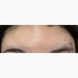 エスクリニック 恵比寿口コミ