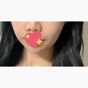 HAAB×DREAM BEAUTY CLINIC 東京本院口コミ