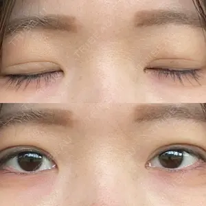 アリエル美容クリニック 大宮院口コミ