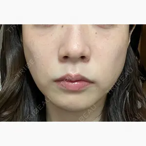 ルラ美容クリニック 上野院口コミ