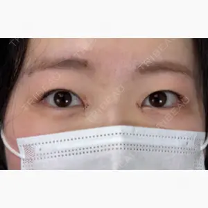 ネビュラクリニック 京都院口コミ