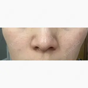 東京美容外科 福岡院口コミ