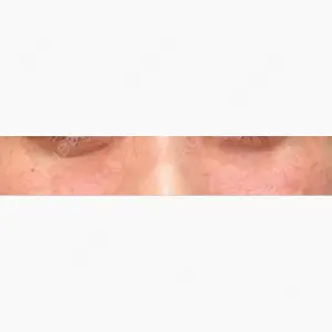 聖心美容クリニック 六本木院口コミ