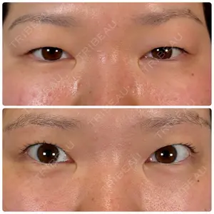 神戸美容外科 ネビュラクリニック口コミ