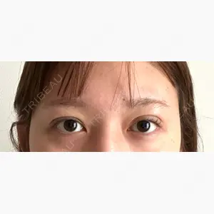パルム美容クリニック口コミ