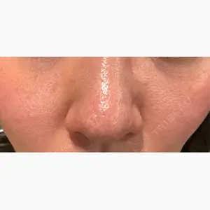 CHARIS BEAUTY CLINIC口コミ