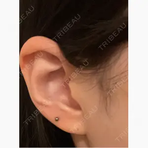 美容皮膚科エルムクリニック 京都院口コミ