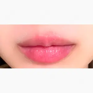 藤・ナチュレ美容クリニック 銀座院口コミ