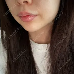 TCB東京中央美容外科 山形院口コミ