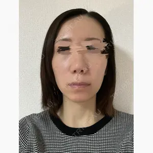 LUHO（ルホ）美容外科口コミ