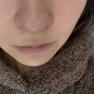 DAILY SKIN CLINIC 新宿院口コミ