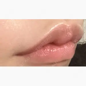 ルラ美容クリニック 渋谷本院口コミ